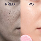 Detail pleti pred používaním a po používaní padu Kōji Glovi